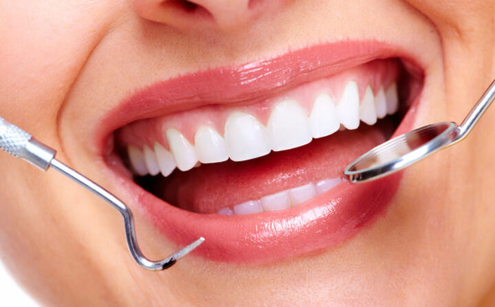 Seeing a dentist in Tukwila: All about composite fillings